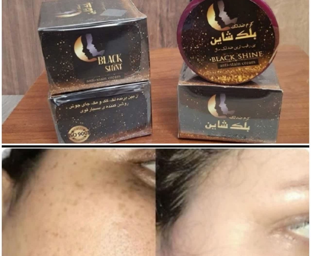 کرم ضد لک گیاهی برند بلک شاین نمای ۲